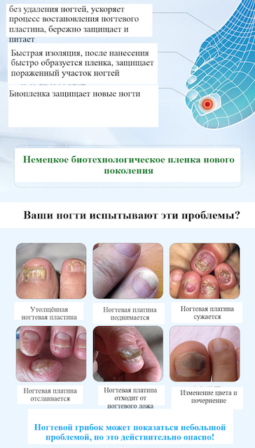 Карандаш для лечения грибка ногтей Clothes Of Skin