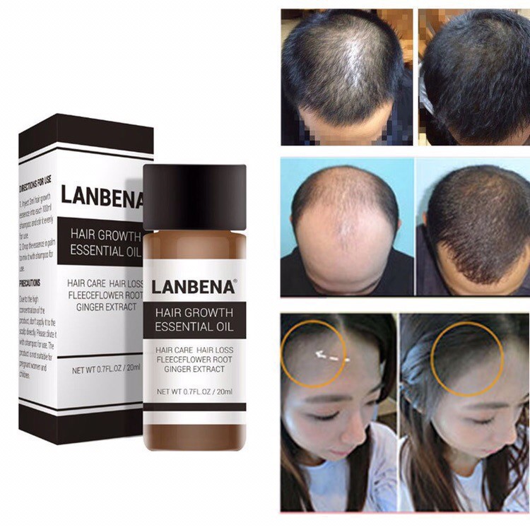 Масло для роста волос Lanbena Hair Growth Essential Oil, 20ml