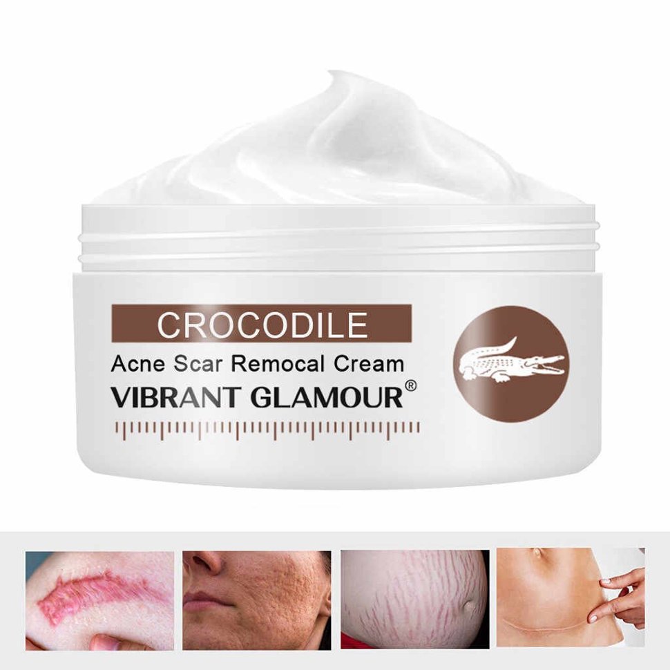 Крем для лица и тела VIBRANT GLAMOUR Crocodile Acne Scar Removal Cream с крокодиловым жиром 30 гр